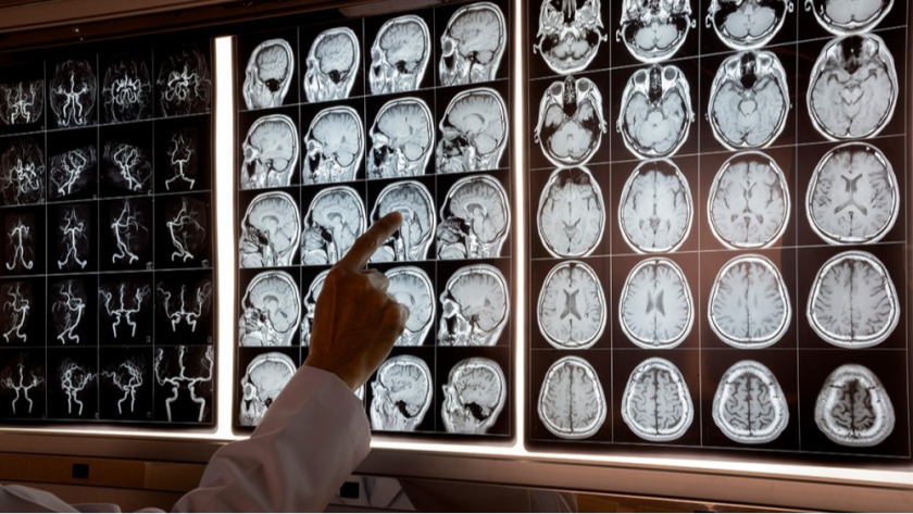 Best Neurologist clinic in Chembur